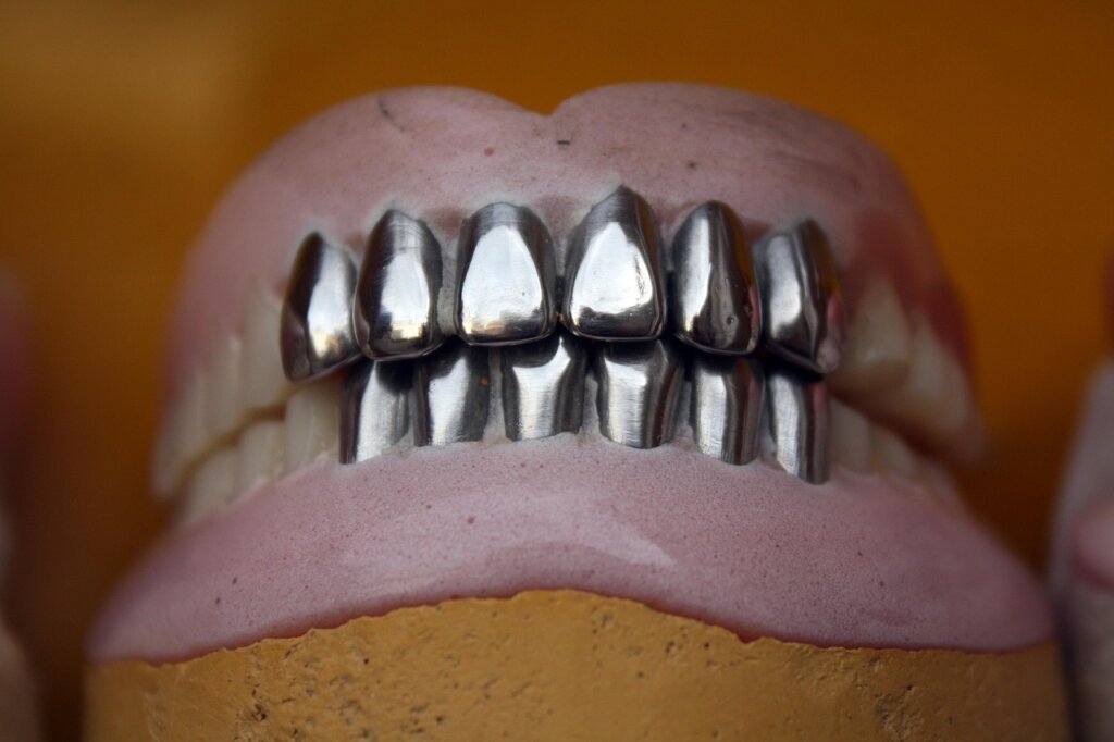 comparison chart of dental implant and denture costs
